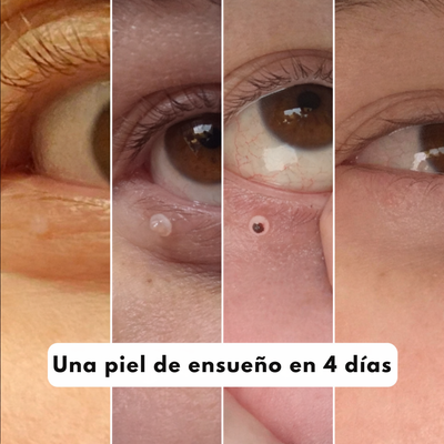 Velura - Piel suave en sólo 4 días
