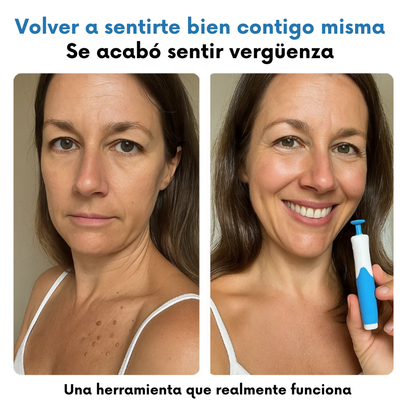 Velura - Piel suave en sólo 4 días